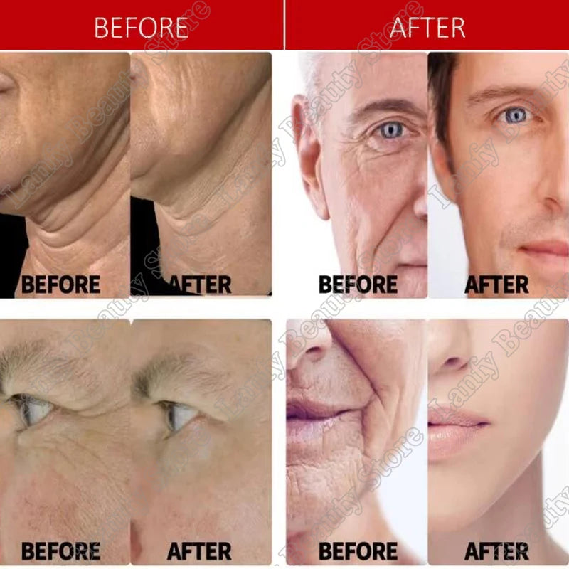 Instant Wrinkle Remover Face Cream Collagen Lifting Firming Fade Fine Lines Anti-Aging Whitening Moisturizing Korean Cosmetics