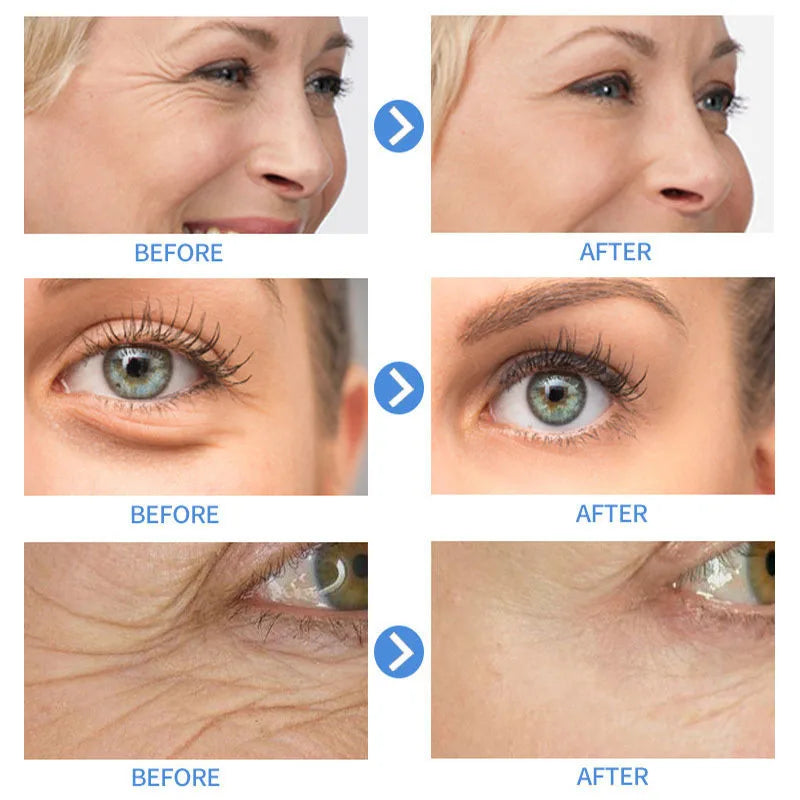 Retinol Wrinkle Remover Face Cream-Anti-Aging Lifting Moisturizing.