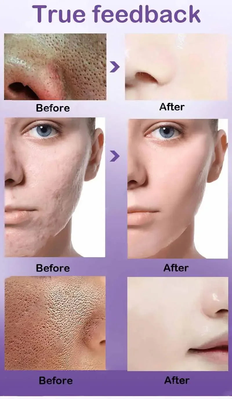Skin Texture & Pore Refining Facial Serum - Resurfacing & Brightening Product