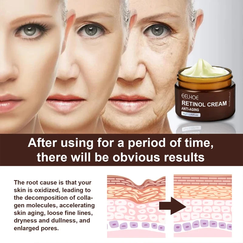 Retinol Wrinkle Remover Face Cream-Anti-Aging Lifting Moisturizing.
