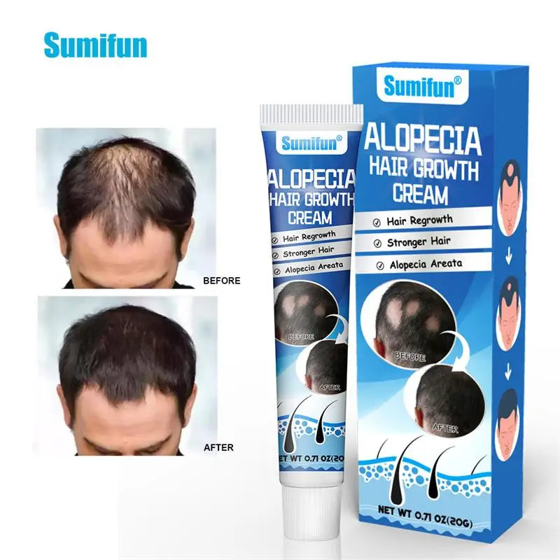 Intensive Scalp Wellness Serum - Premium Hair Nourishment (20g)