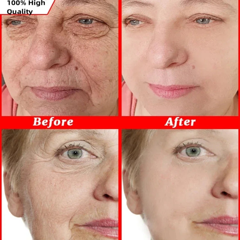 Retinol Skin Care Serum Set - Hydrating & Brightening