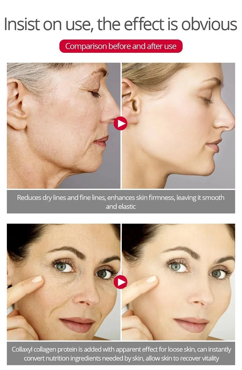 Retinol Face Cream - Brightening & Hydrating Skin Care