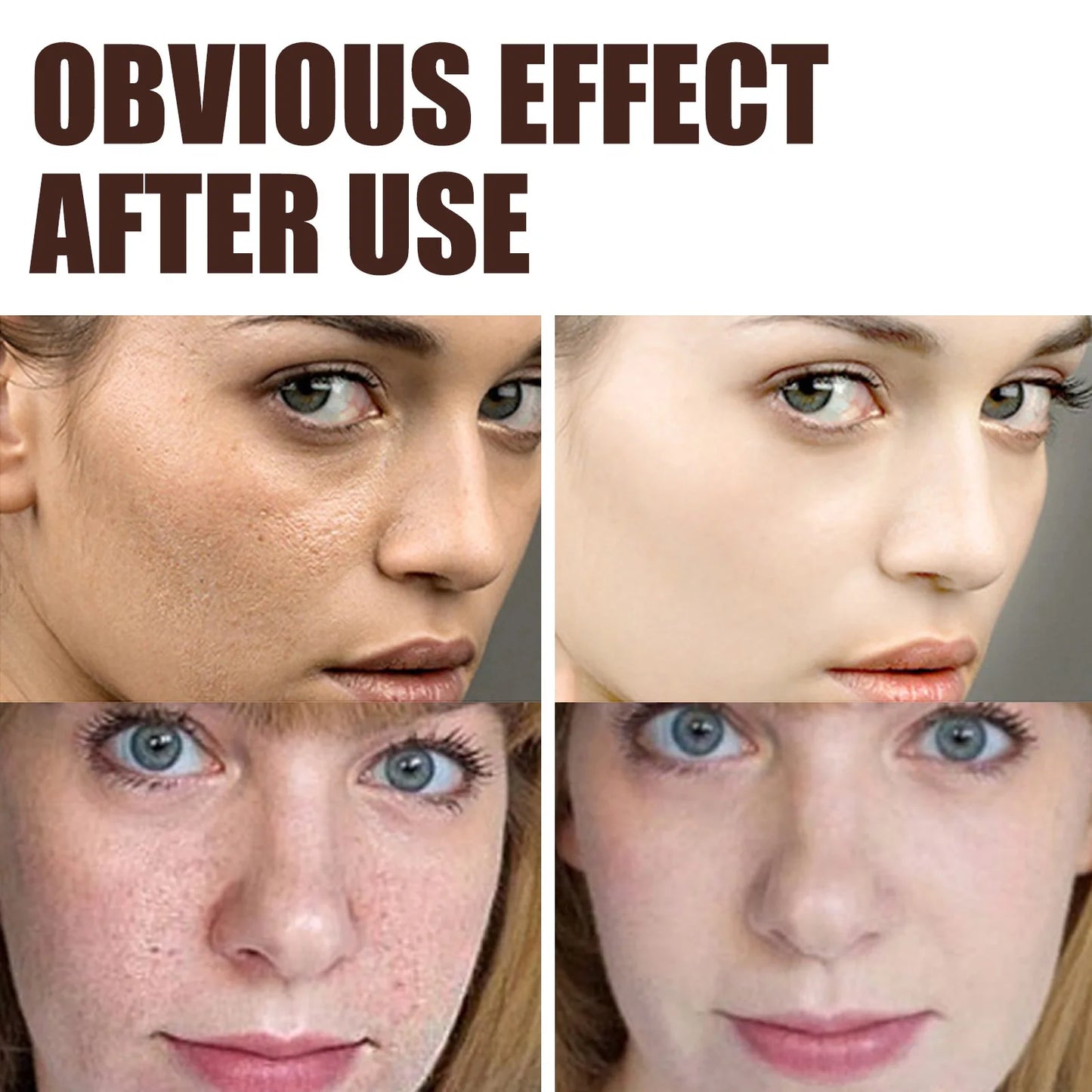 Retinol Wrinkle Remover Face Cream-Anti-Aging Lifting Moisturizing.
