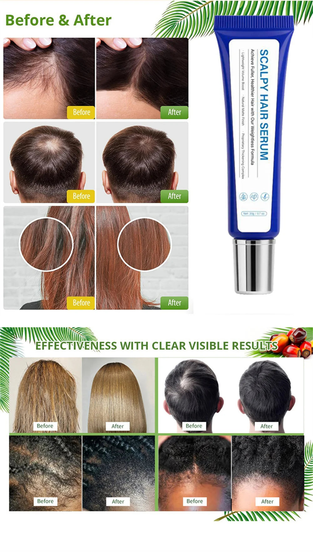 Premium Scalp Nourishing Serum - Intensive Hair Wellness