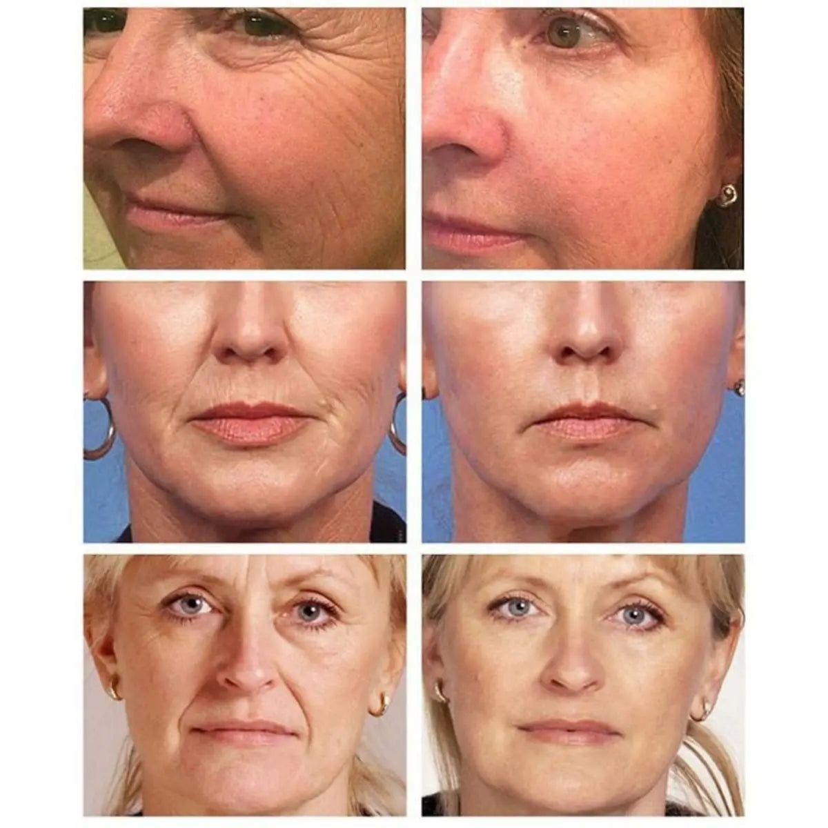 Retinol Face Cream Anti-Aging Remove Working, Firming & Lifting