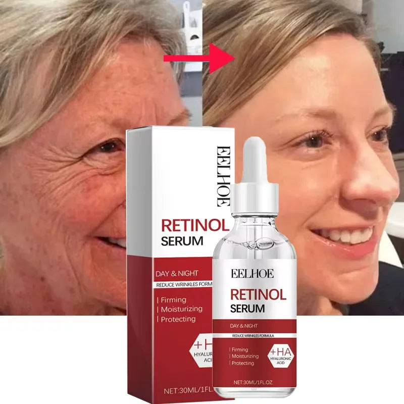 Retinol Skin Care Serum Set - Hydrating & Brightening
