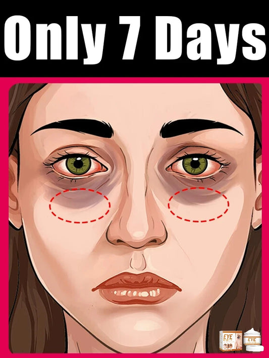 Anti - Wrinkle Eye Cream Massager - Dark Circle & Puffiness Reducing Tool