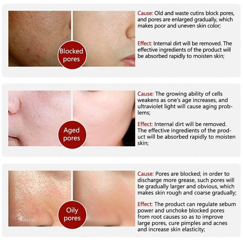 Skin Texture & Pore Refining Facial Serum - Resurfacing & Brightening Product