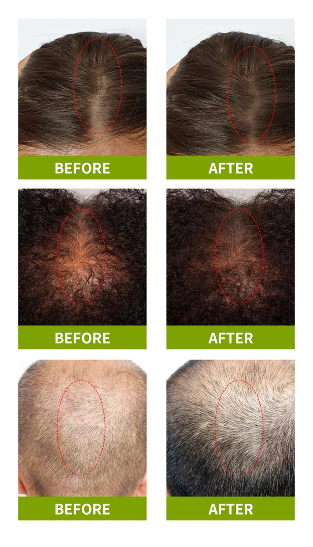 Premium Scalp Nourishing Serum - Intensive Hair Wellness