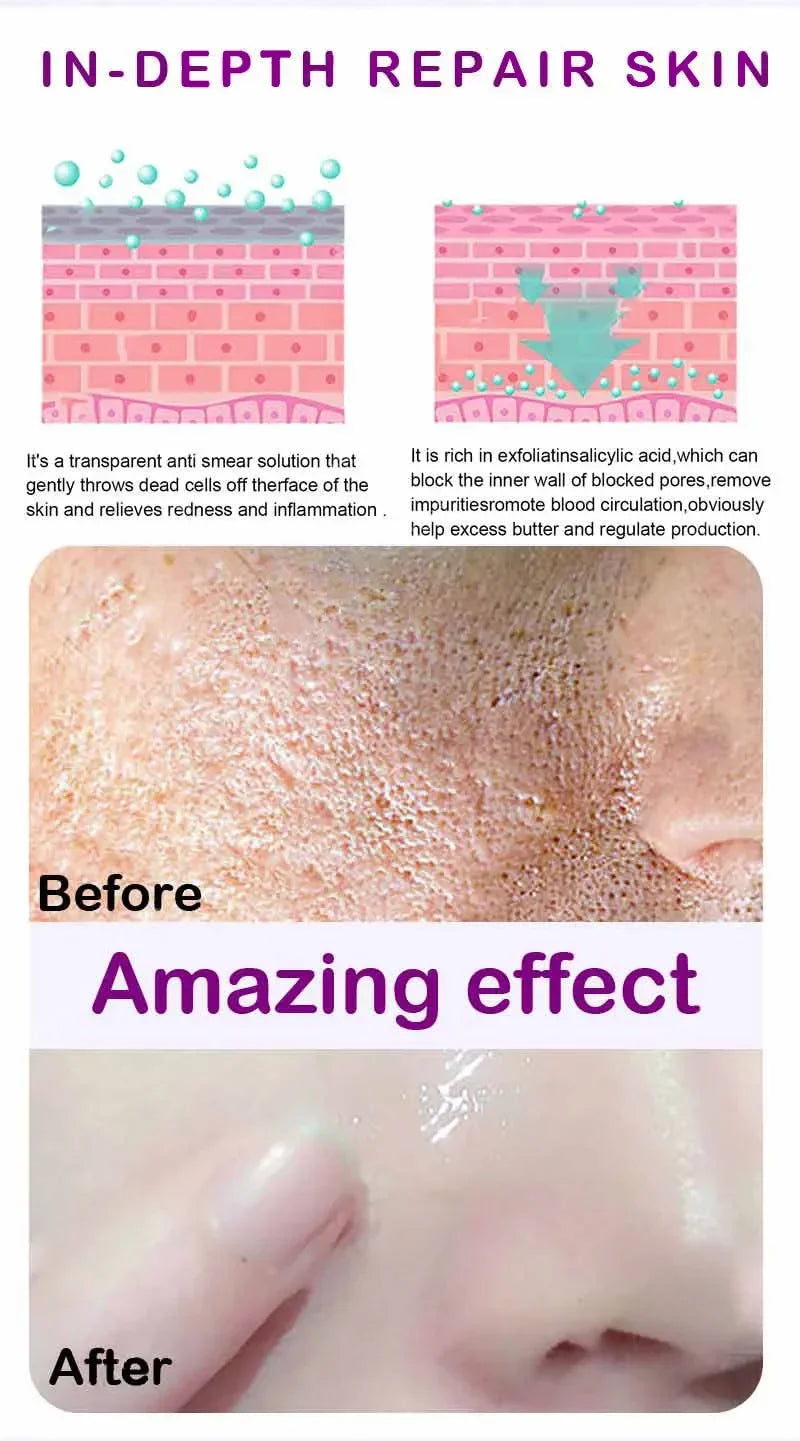 Skin Texture & Pore Refining Facial Serum - Resurfacing & Brightening Product