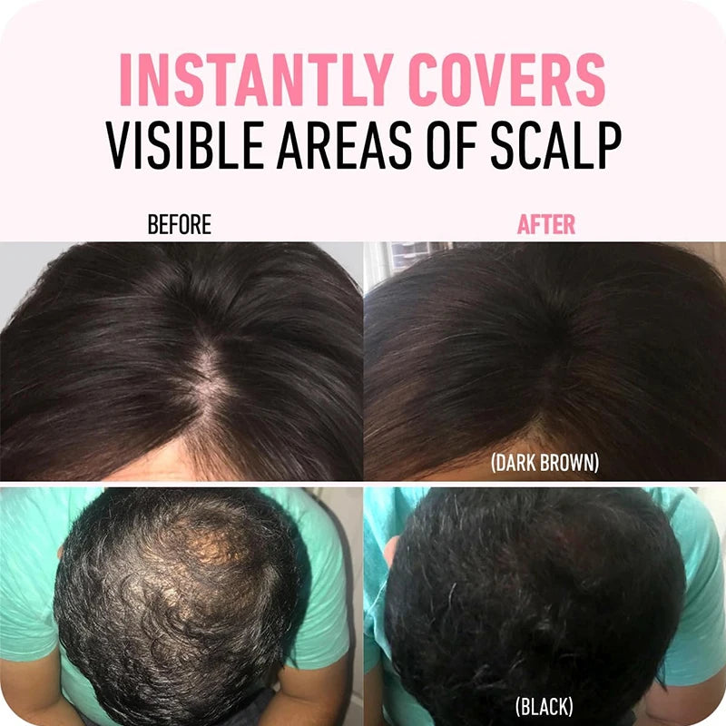 Hairline Shadow Power-Instantly Conceal Thinning Hair & Receding Hairline