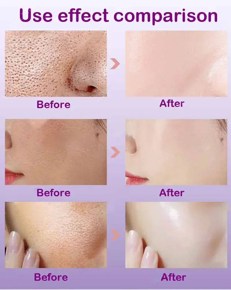 Skin Texture & Pore Refining Facial Serum - Resurfacing & Brightening Product