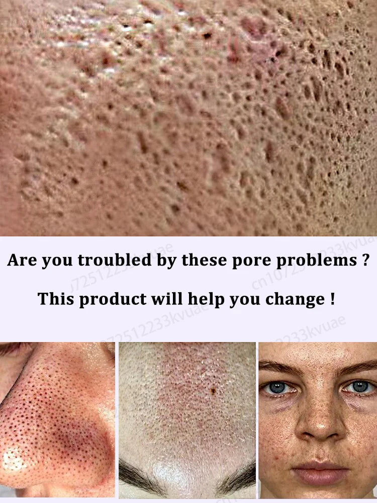 Pore repair essence, repair rough and dull pores, restore perfect skin