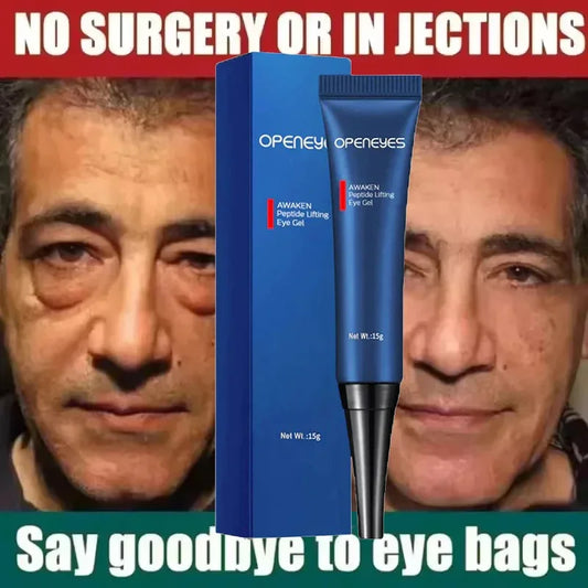 Men's Retinol Eye Cream - Dark circle & Eye Bags Remover