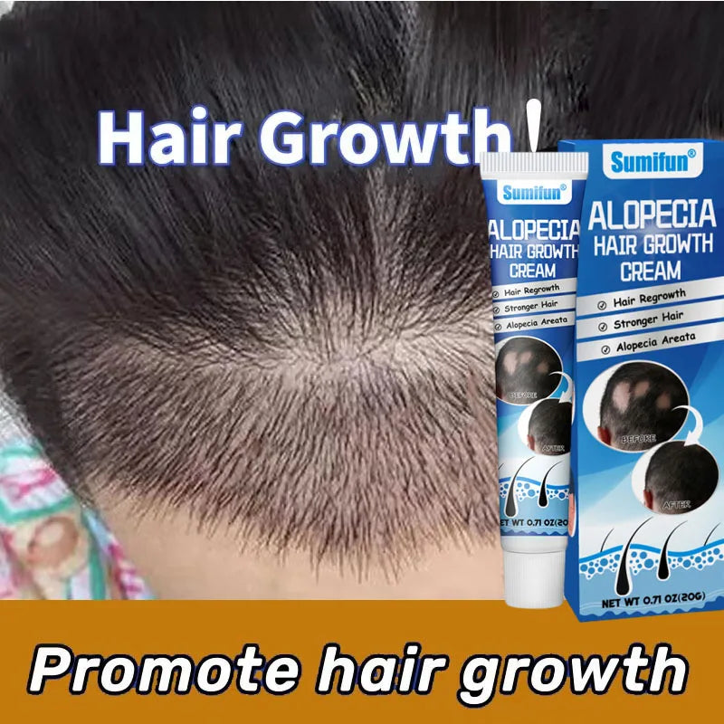 Intensive Scalp Wellness Serum - Premium Hair Nourishment (20g)