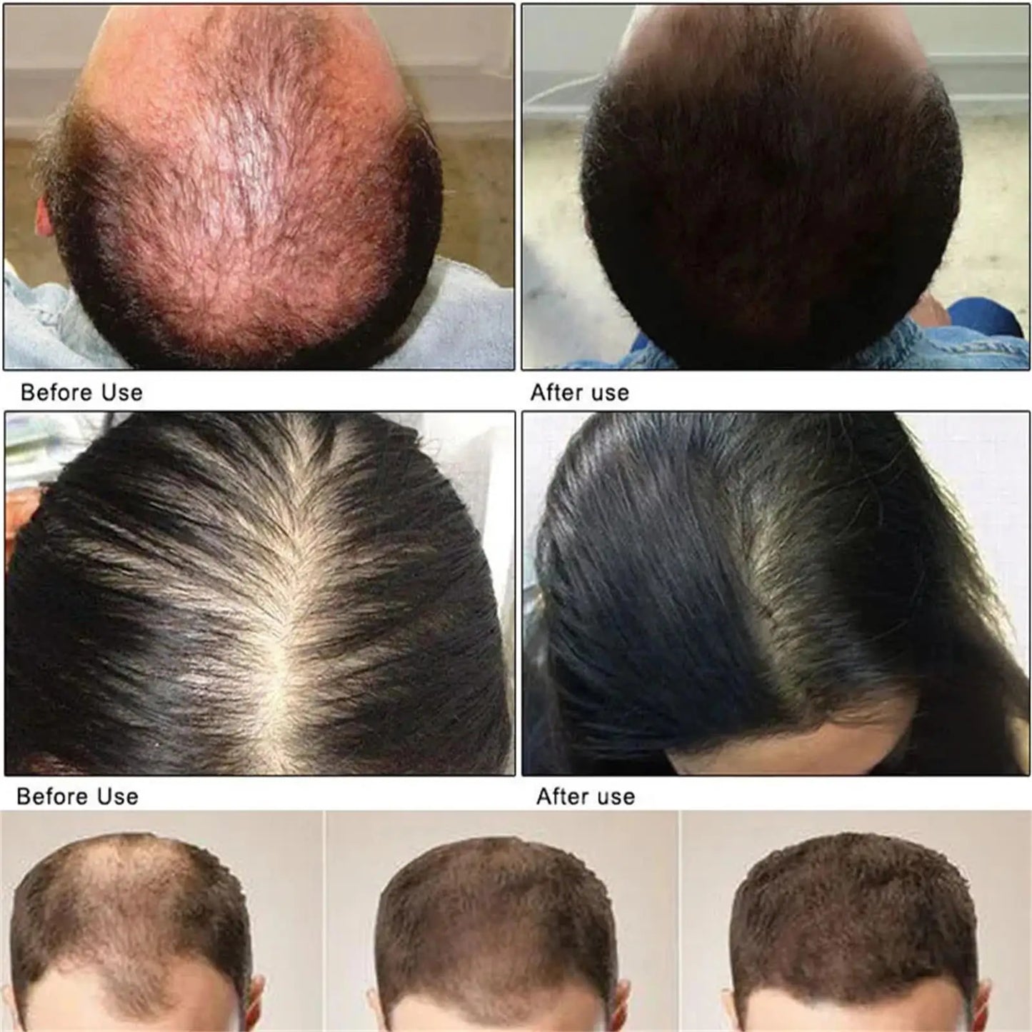 Intensive Scalp Wellness Serum - Premium Hair Nourishment (20g)