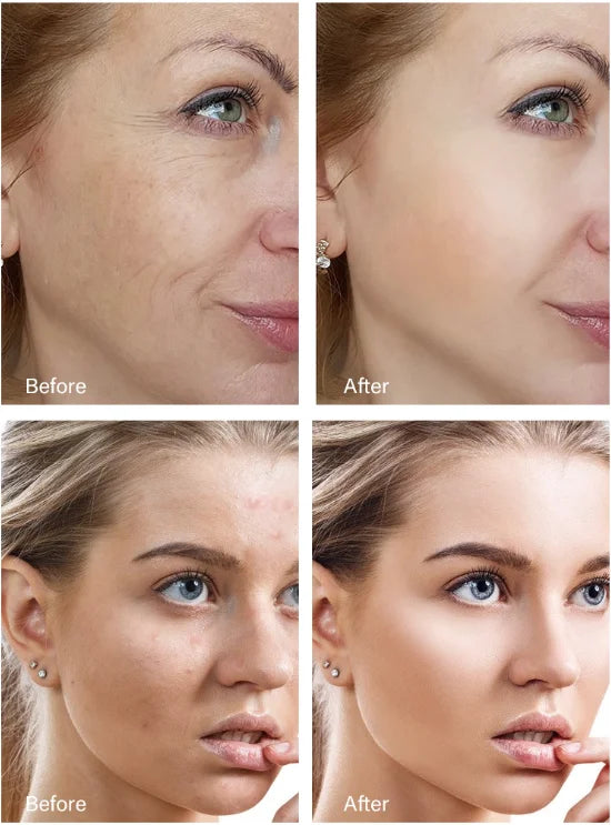 Retinol Wrinkle Remover Face Cream-Anti-Aging Lifting Moisturizing.