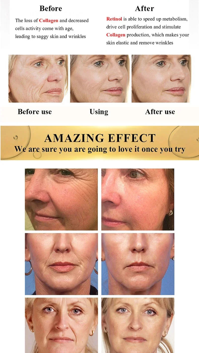 Retinol Face Cream - Brightening & Hydrating Skin Care