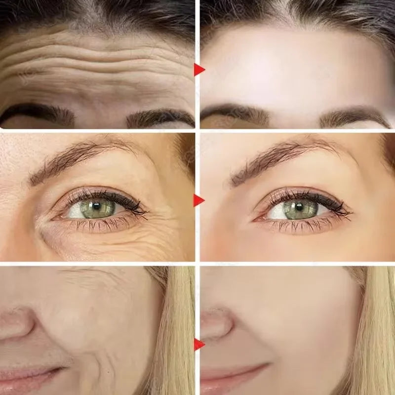 Retinol Skin Care Serum Set - Hydrating & Brightening