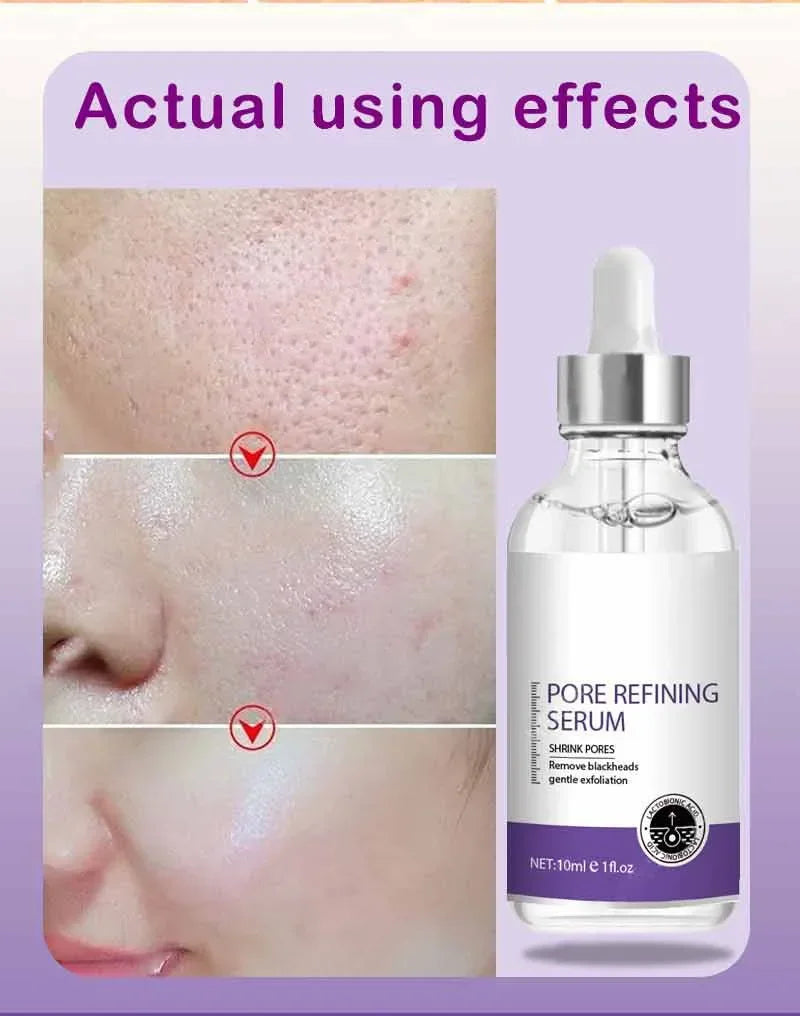 Skin Texture & Pore Refining Facial Serum - Resurfacing & Brightening Product