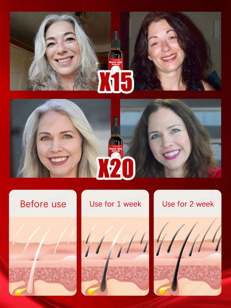 Black Hair Essence- 7 Gray Hair Color Restoration Treatment