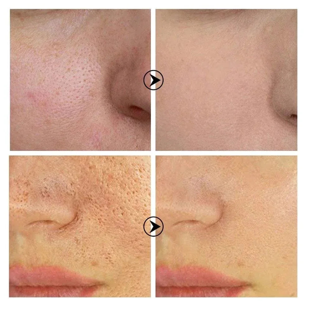 Skin Texture & Pore Refining Facial Serum - Resurfacing & Brightening Product