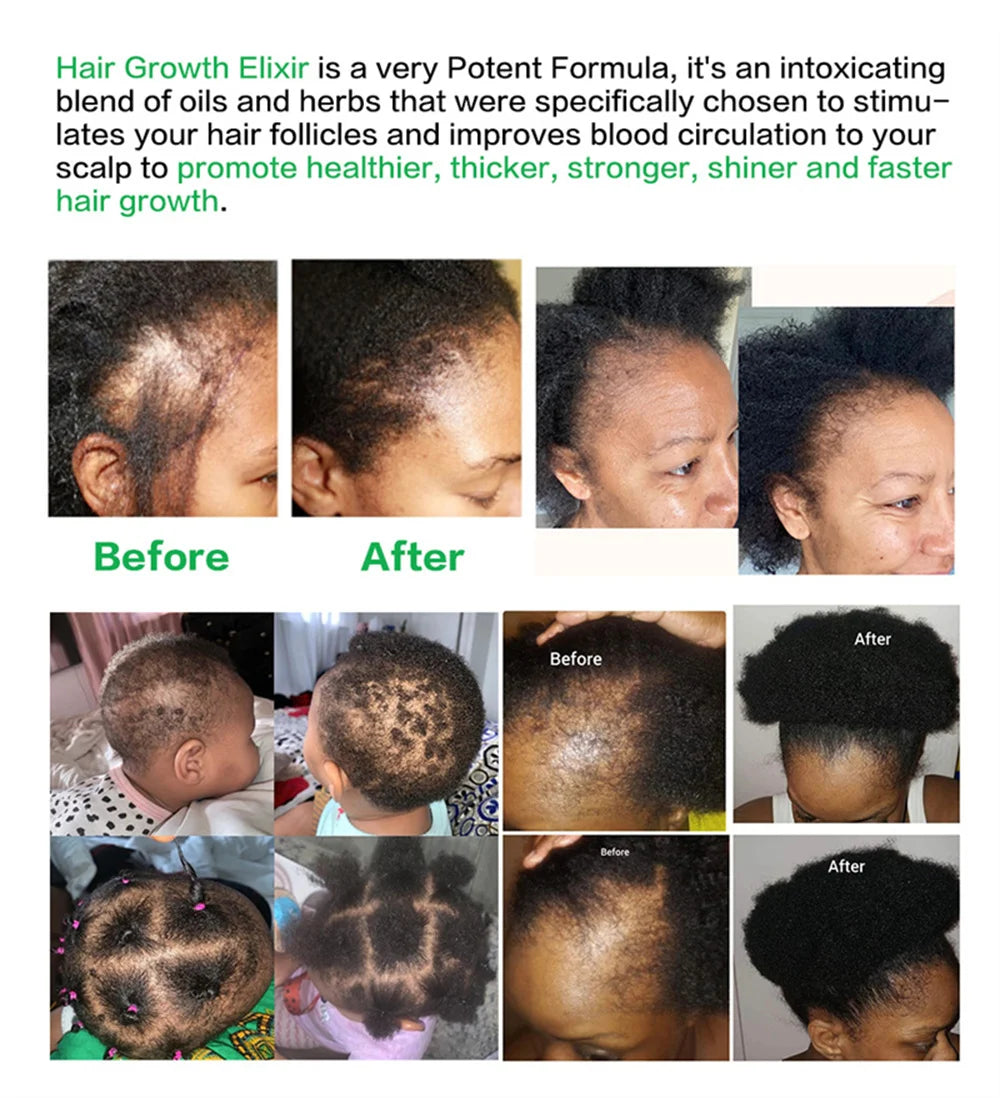 Premium Scalp Nourishing Serum - Intensive Hair Wellness