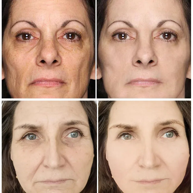 Retinol Wrinkle Remover Face Cream-Anti-Aging Lifting Moisturizing.