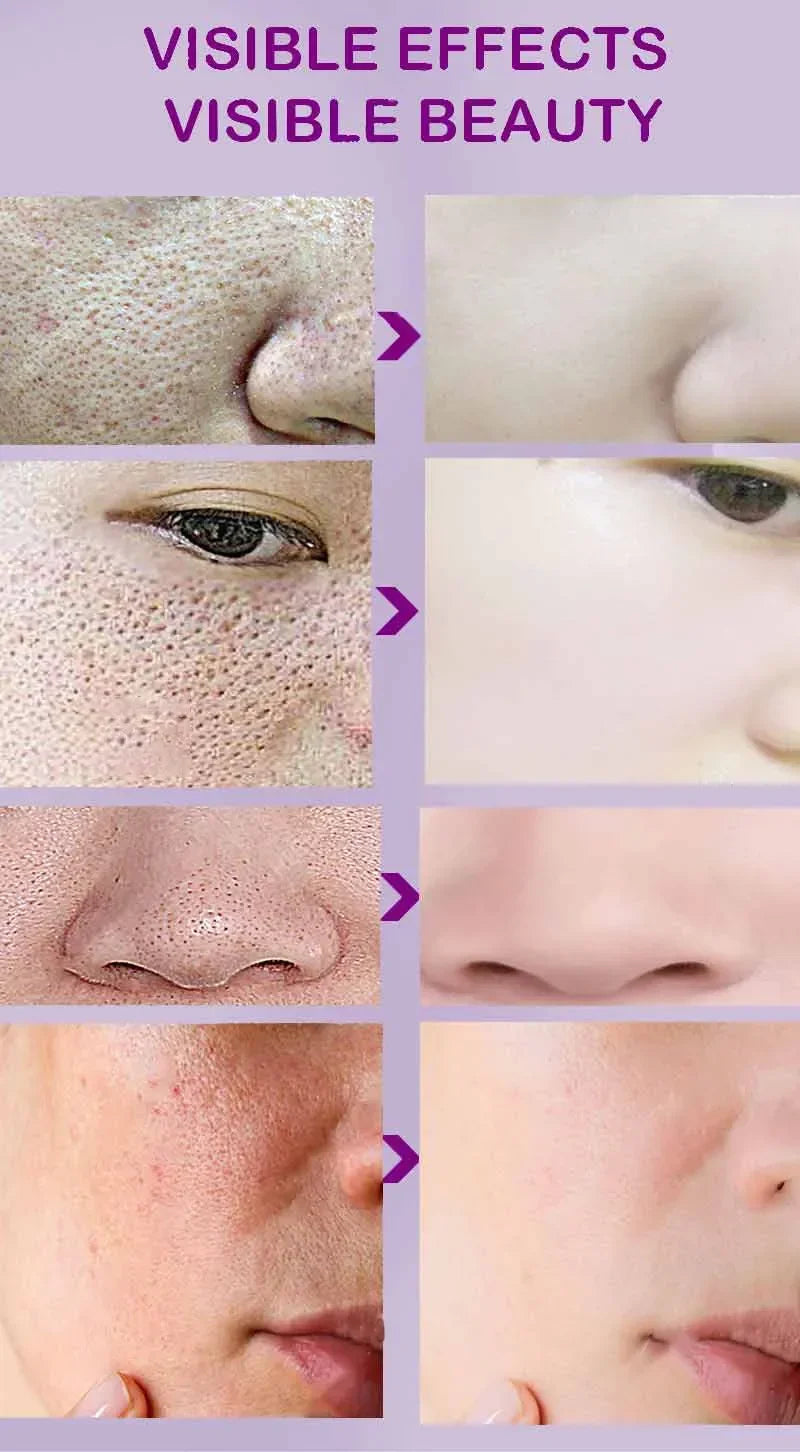 Skin Texture & Pore Refining Facial Serum - Resurfacing & Brightening Product