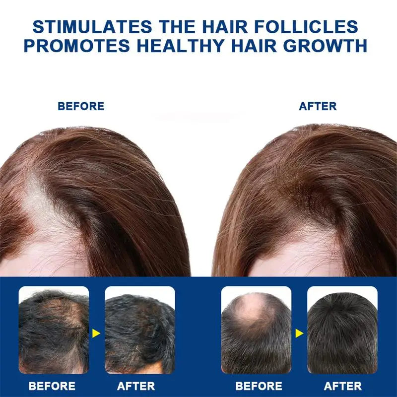 Intensive Scalp Wellness Serum - Premium Hair Nourishment (20g)