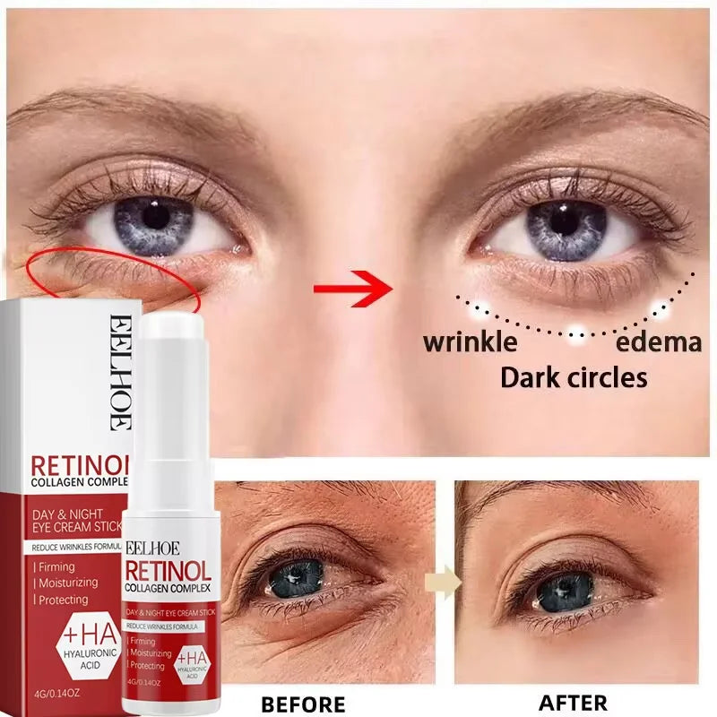 Retinol Skin Care Serum Set - Hydrating & Brightening