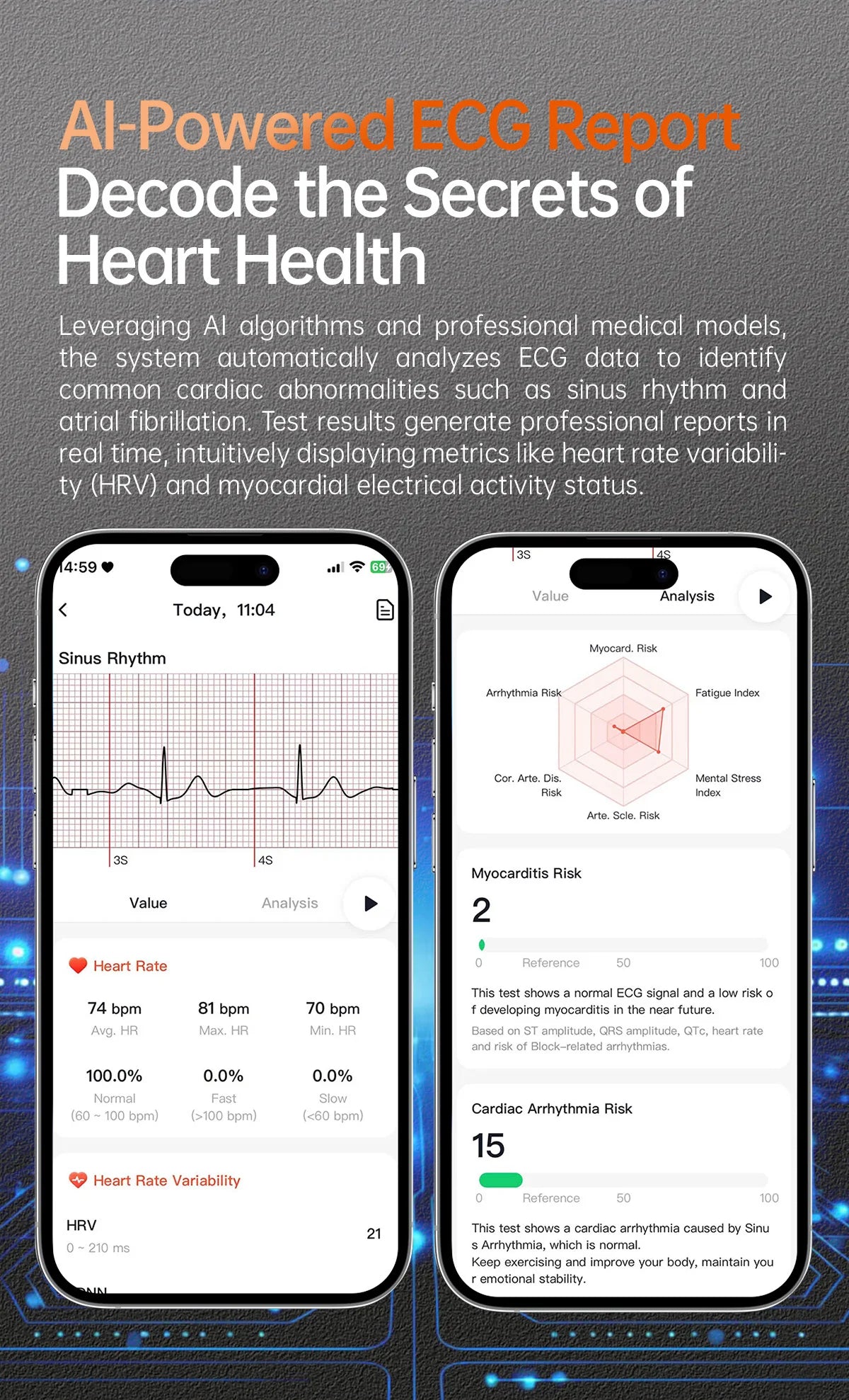 2025 Clinical Grade Laser Therapy Smartwatch - Blood Pressure Heart Rate Monitor