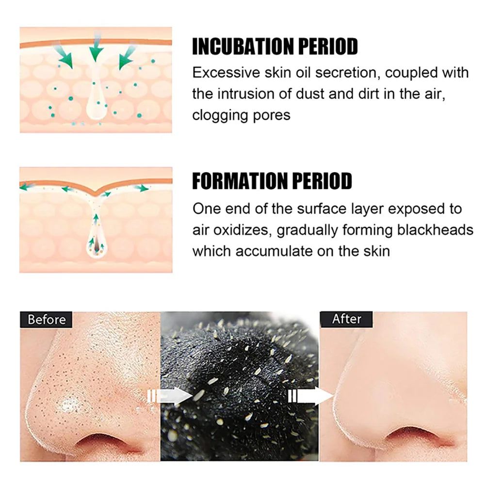 Nose Blackhead Remover Mask - Pore Cleansing & Acne Treatment Strips (10/20/100 PCS