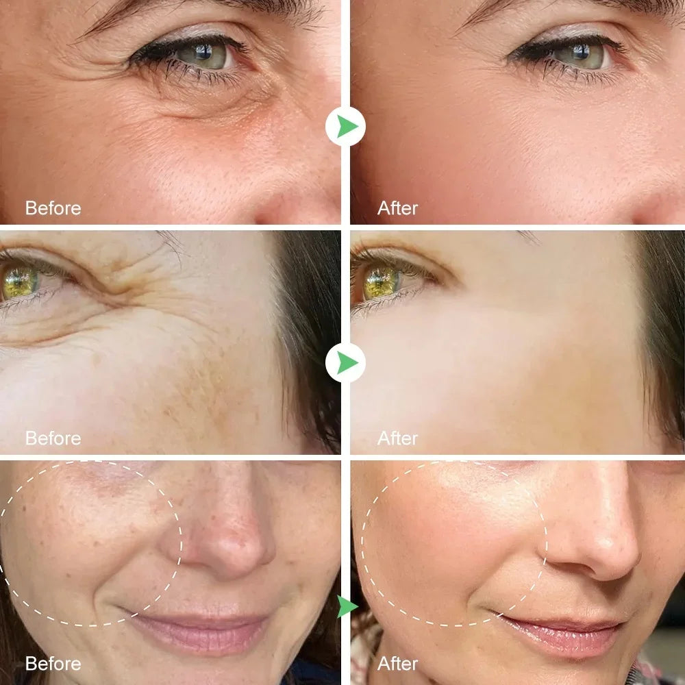 Retinol Skin Care Serum Set - Hydrating & Brightening