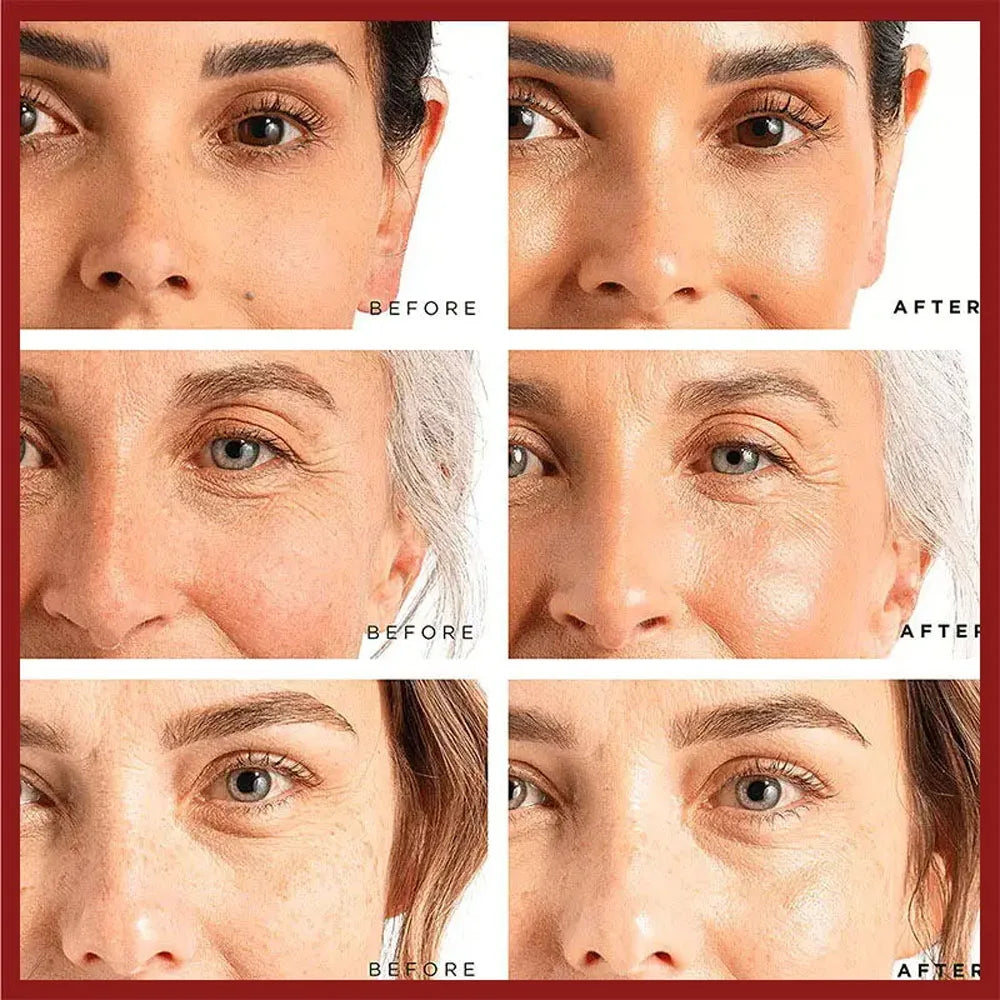 Retinol Wrinkle Remover Face Cream-Anti-Aging Lifting Moisturizing.