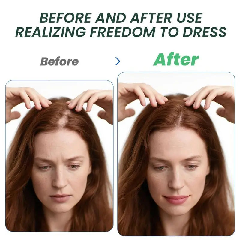 Intensive Scalp Wellness Serum - Premium Hair Nourishment (20g)