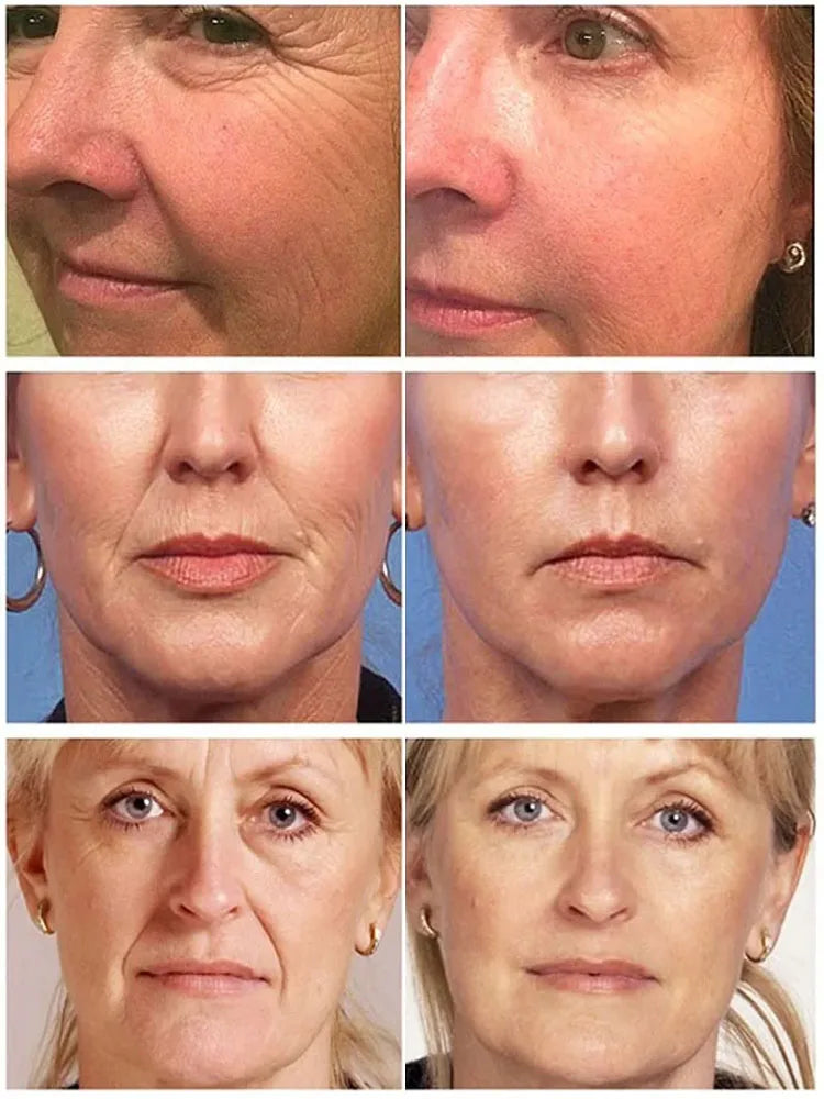 Retinol Skin Care Serum Set - Hydrating & Brightening