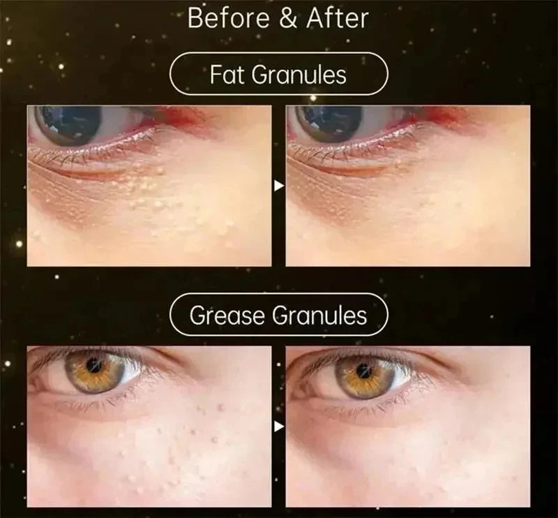 Premium Eye Cream - Smoothing & Firming Treatment