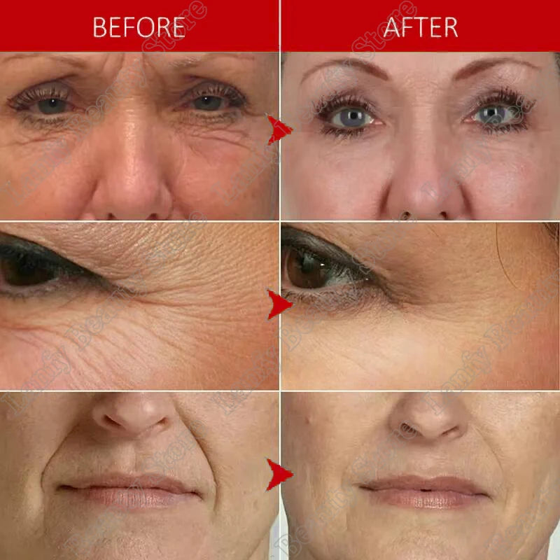 Instant Wrinkle Remover Face Cream Collagen Lifting Firming Fade Fine Lines Anti-Aging Whitening Moisturizing Korean Cosmetics