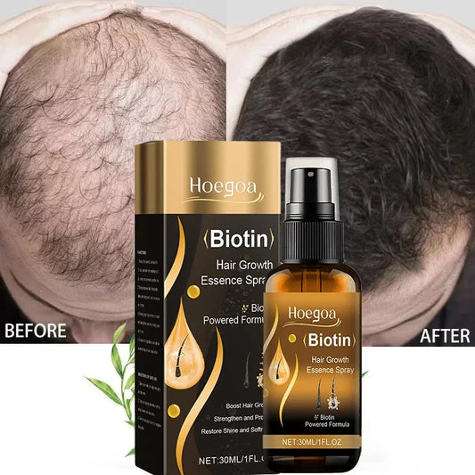 Biotin Hair Growth Spray - Scalp Care Treatment
