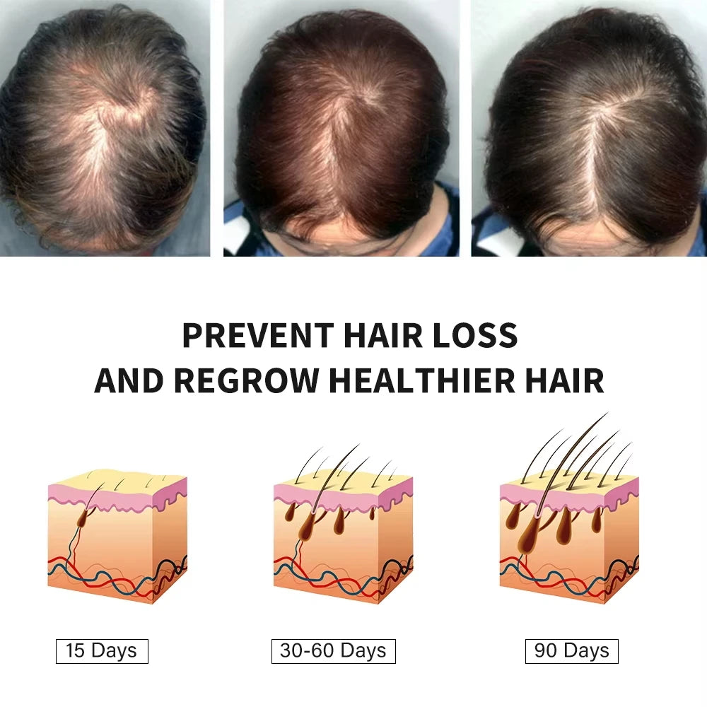 Intensive Scalp Wellness Serum - Premium Hair Nourishment (20g)