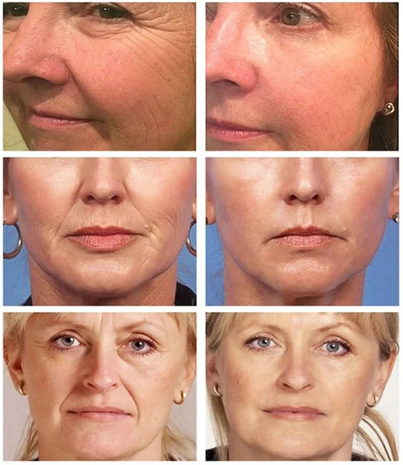 Retinol Skin Care Serum Set - Hydrating & Brightening