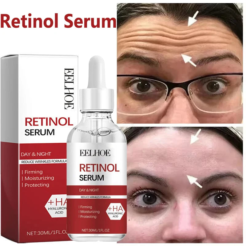 Retinol Skin Care Serum Set - Hydrating & Brightening
