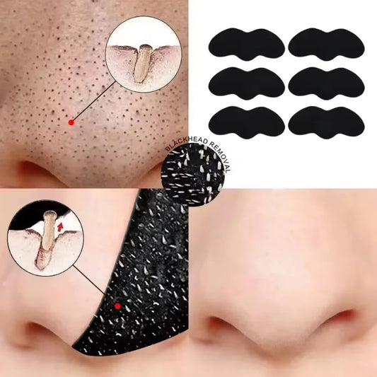 Nose Blackhead Remover Mask - Pore Cleansing & Acne Treatment Strips (10/20/100 PCS