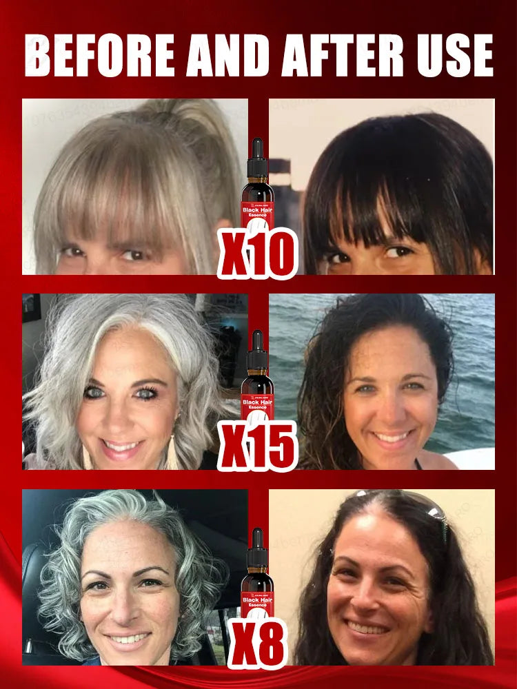 Black Hair Essence- 7 Gray Hair Color Restoration Treatment