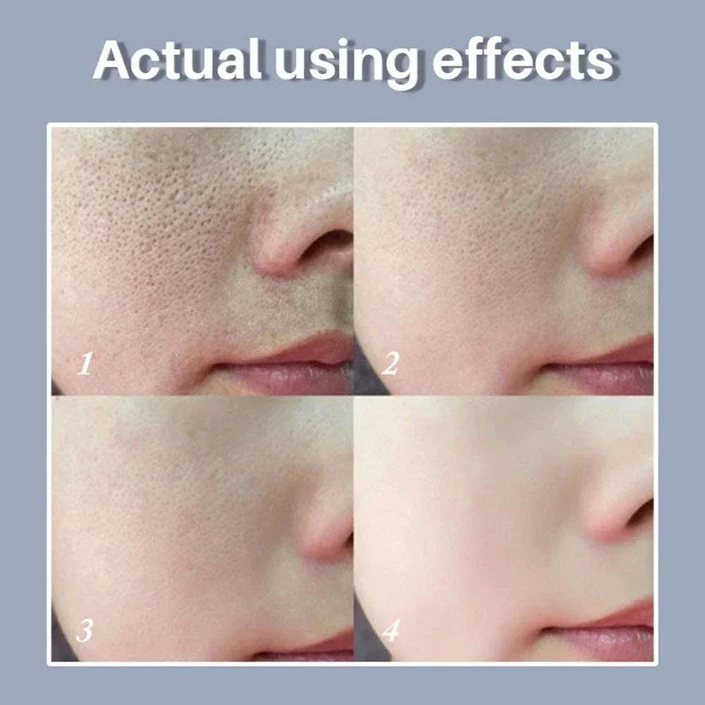 Skin Texture & Pore Refining Facial Serum - Resurfacing & Brightening Product