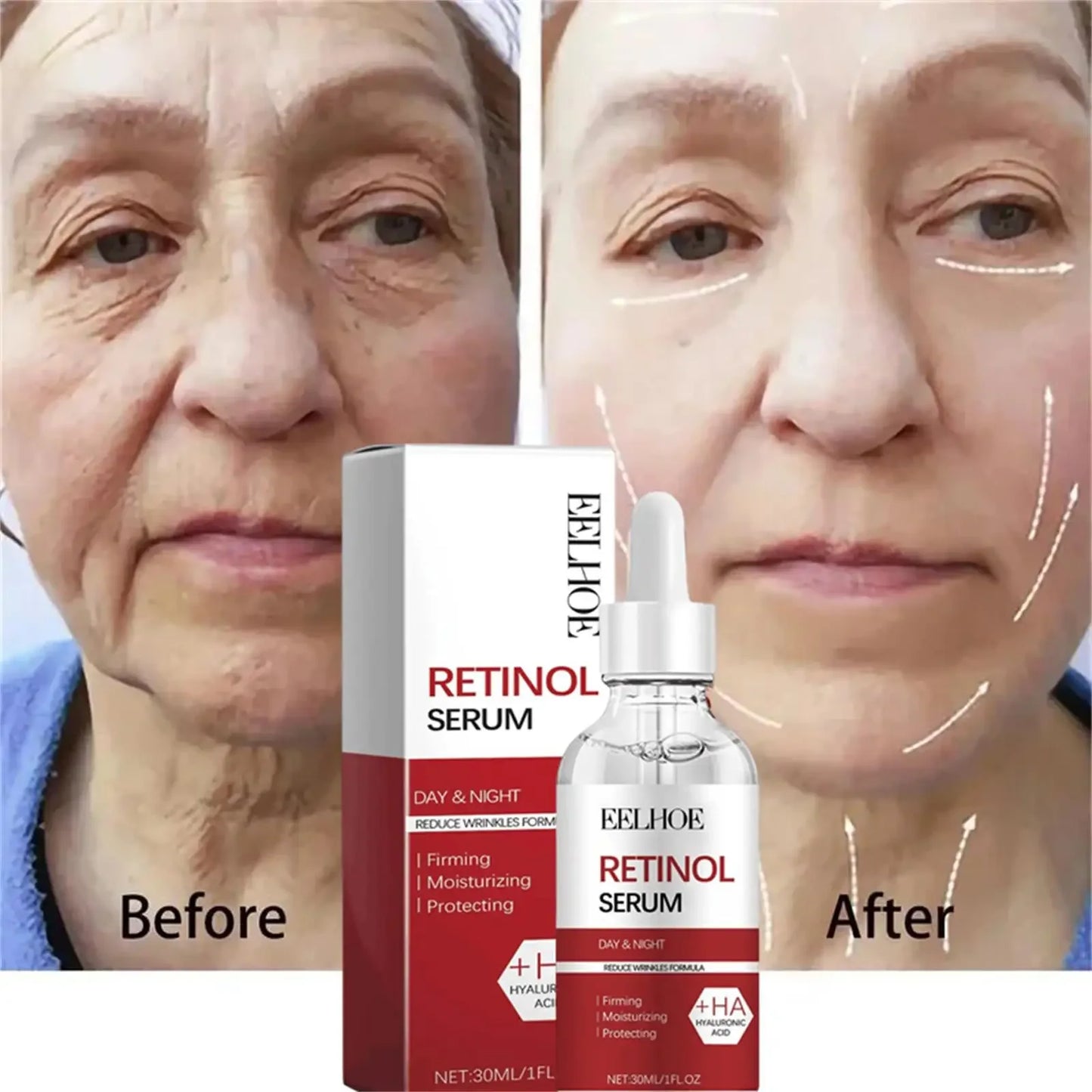 Retinol Skin Care Serum Set - Hydrating & Brightening