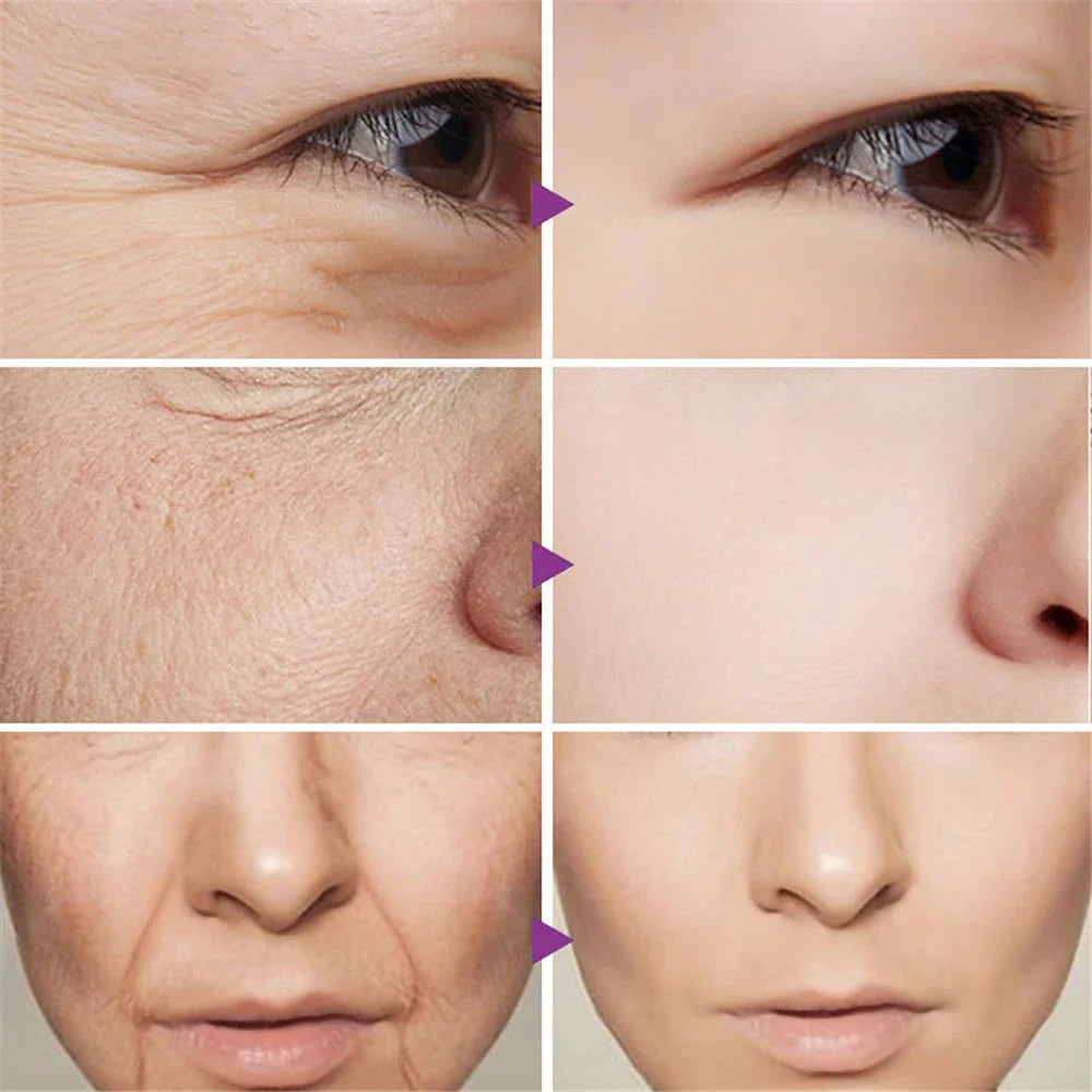 Retinol Face Cream - Brightening & Hydrating Skin Care