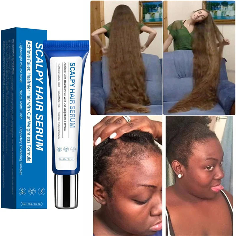 Premium Scalp Nourishing Serum - Intensive Hair Wellness